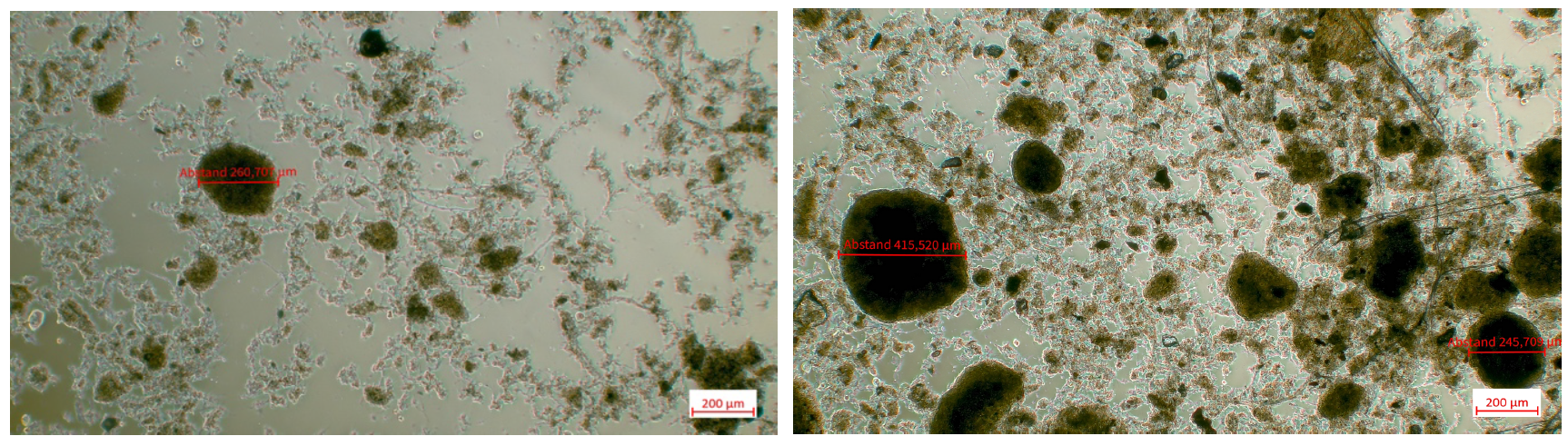 Mikroskopische Aufnahmen des Schlammes aus dem Hydrozyklonober- (links) und -unterlauf (rechts) der Anlage U (eigene Darstellung) Mikroskopische Aufnahmen des Schlammes aus dem Hydrozyklonober- (links) und -unterlauf (rechts) der Anlage U (eigene Darstellung)