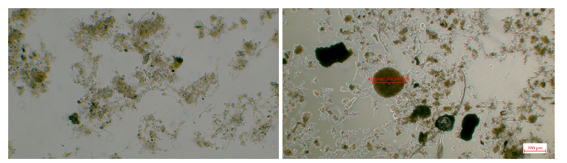 Mikroskopische Aufnahmen des Schlammes aus dem Hydrozyklonober- (links) und -unterlauf (rechts) der Anlage B (eigene Darstellung) Mikroskopische Aufnahmen des Schlammes aus dem Hydrozyklonober- (links) und -unterlauf (rechts) der Anlage B (eigene Darstellung)