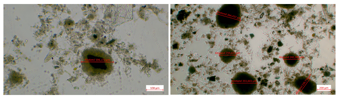 Mikroskopische Aufnahmen des Schlammes aus dem Hydrozyklonober- (links) und -unterlauf (rechts) der Anlage S (eigene Darstellung) Mikroskopische Aufnahmen des Schlammes aus dem Hydrozyklonober- (links) und -unterlauf (rechts) der Anlage S (eigene Darstellung)
