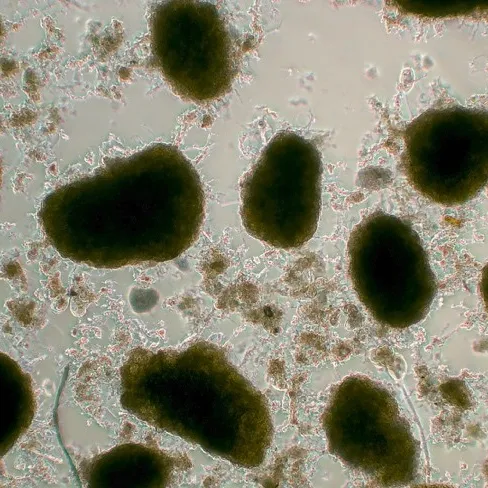 Mikroskopische Aufnahme des Schlammes