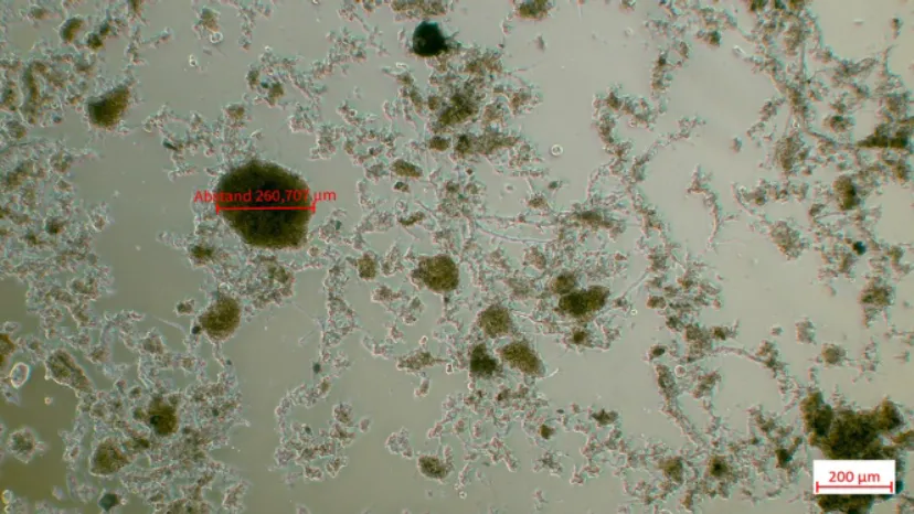 Mikroskopische Aufnahmen des Schlammes aus dem Hydrozyklonober- (links) der Anlage U (eigene Darstellung)