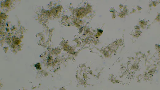 Mikroskopische Aufnahmen des Schlammes aus dem Hydrozyklonober der Anlage B (eigene Darstellung)