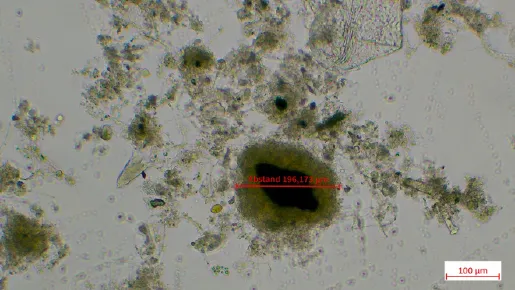 Mikroskopische Aufnahmen des Schlammes aus dem Hydrozyklonober der Anlage S (eigene Darstellung)