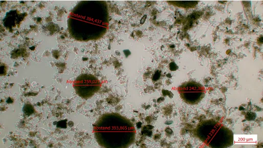 Mikroskopische Aufnahme des Schlammes aus dem Hydrozyklonunterlauf der Anlage S (eigene Darstellung).
