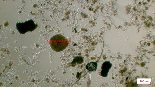 Mikroskopische Aufnahme des Schlammes aus dem Hydrozyklonunterlauf der Anlage B (eigene Darstellung).