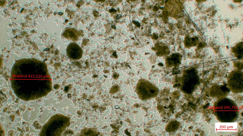 Mikroskopische Aufnahme des Schlammes aus dem Hydrozyklonunterlauf der Anlage U (eigene Darstellung).